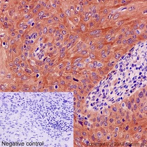 Immunohistochemistry (Formalin/PFA-fixed paraffin-embedded sections) - Anti-DSTN antibody [EPR15828] - BSA and Azide free (AB251129), expandable thumbnail
