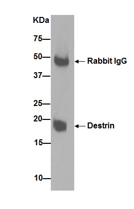 Immunoprecipitation - Anti-DSTN antibody [EPR15828] - BSA and Azide free (AB251129), expandable thumbnail