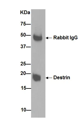 Immunoprecipitation - Anti-DSTN antibody [EPR15828] - BSA and Azide free (AB251129)