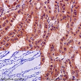 Immunohistochemistry (Formalin/PFA-fixed paraffin-embedded sections) - Anti-DTN-A antibody [EPR14112] (AB191395)