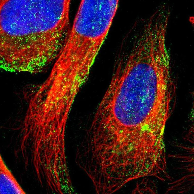 Immunocytochemistry/ Immunofluorescence - Anti-DTX3L antibody (AB254656)