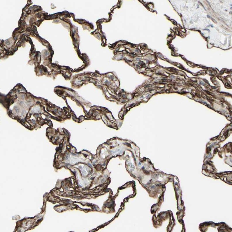 Immunohistochemistry (Formalin/PFA-fixed paraffin-embedded sections) - Anti-DTX3L antibody (AB254656)