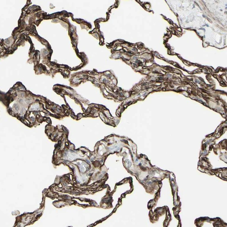 Immunohistochemistry (Formalin/PFA-fixed paraffin-embedded sections) - Anti-DTX3L antibody (AB254656)