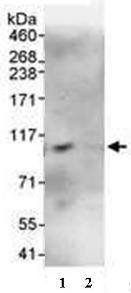 Immunoprecipitation - Anti-DTX3L antibody (AB70621)