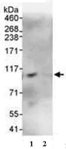 Immunoprecipitation - Anti-DTX3L antibody (AB70621)