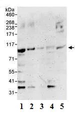 Western blot - Anti-DTX3L antibody (AB70621)