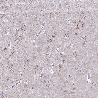 Immunohistochemistry (Formalin/PFA-fixed paraffin-embedded sections) - Anti-DTX4 antibody (AB254952)