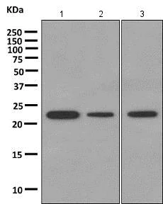 Western blot - Anti-DTYMK antibody [EPR10163] (AB154867)