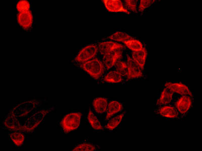 Immunocytochemistry/ Immunofluorescence - Anti-DTYMK antibody [EPR10163] - BSA and Azide free (AB249166), expandable thumbnail