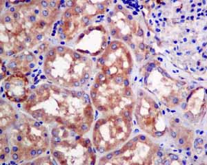 Immunohistochemistry (Formalin/PFA-fixed paraffin-embedded sections) - Anti-DTYMK antibody [EPR10163] - BSA and Azide free (AB249166), expandable thumbnail
