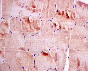 Immunohistochemistry (Formalin/PFA-fixed paraffin-embedded sections) - Anti-DTYMK antibody [EPR10163] - BSA and Azide free (AB249166)