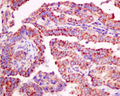 Immunohistochemistry (Formalin/PFA-fixed paraffin-embedded sections) - Anti-DTYMK antibody [EPR10163] - BSA and Azide free (AB249166), expandable thumbnail