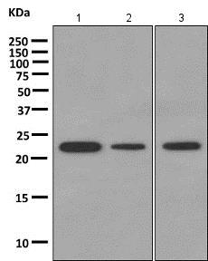 Western blot - Anti-DTYMK antibody [EPR10163] - BSA and Azide free (AB249166), expandable thumbnail