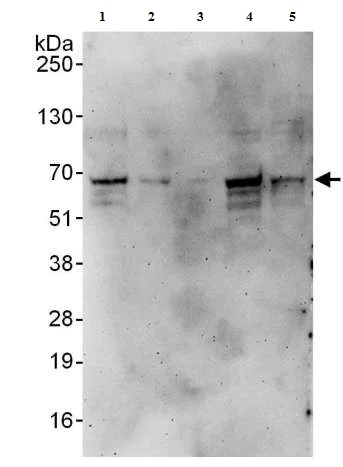 Western blot - Anti-DUBA antibody (AB176727)