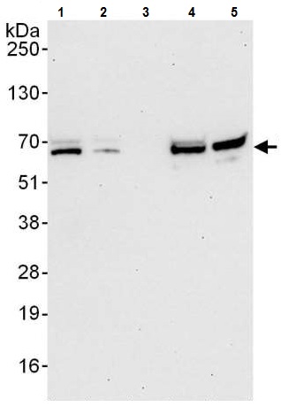 Western blot - Anti-DUBA antibody (AB225558)