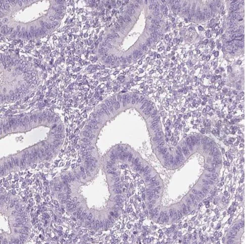 Immunohistochemistry (Formalin/PFA-fixed paraffin-embedded sections) - Anti-DUBA2 antibody (AB185352)