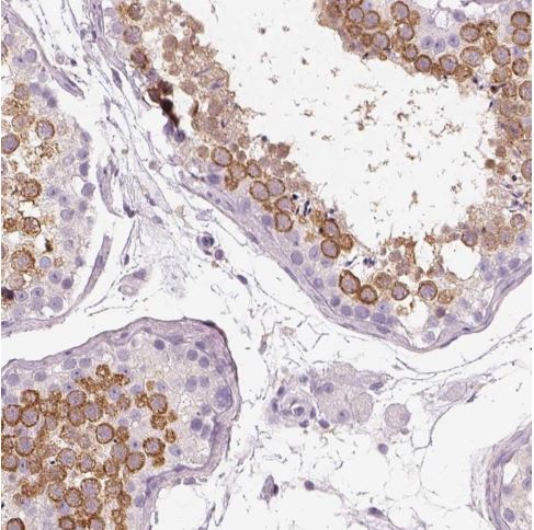 Immunohistochemistry (Formalin/PFA-fixed paraffin-embedded sections) - Anti-DUBA2 antibody (AB185352)