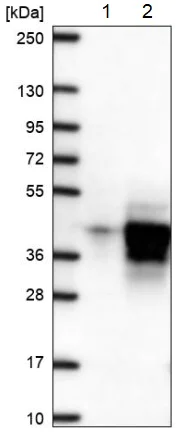 Western blot - Anti-DUBA2 antibody (AB185352)