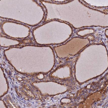 Immunohistochemistry (Formalin/PFA-fixed paraffin-embedded sections) - Anti-DUOXA1 antibody (AB243469)