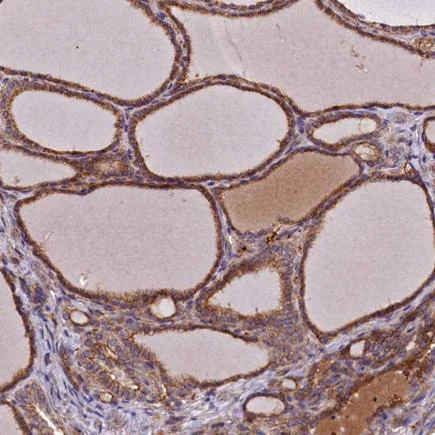 Immunohistochemistry (Formalin/PFA-fixed paraffin-embedded sections) - Anti-DUOXA1 antibody (AB243469)