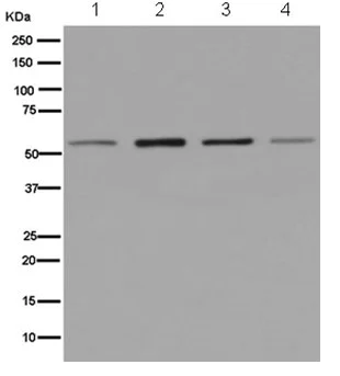Western blot - Anti-DUS2L antibody [EPR14042-41] - BSA and Azide free (AB250133)
