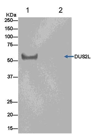 Immunoprecipitation - Anti-DUS2L antibody [EPR14042] - BSA and Azide free (AB250475)
