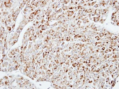 Immunohistochemistry (Formalin/PFA-fixed paraffin-embedded sections) - Anti-DUSP10 antibody (AB228987)