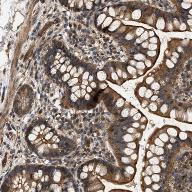 Immunohistochemistry (Formalin/PFA-fixed paraffin-embedded sections) - Anti-DUSP14 antibody (AB272587)