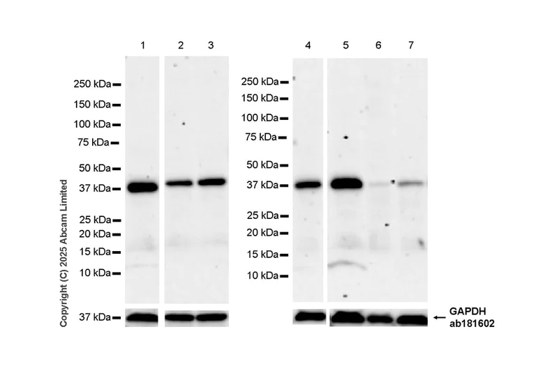 Western blot - Anti-DUSP2/PAC1 antibody [EPR29656-23] (AB323536)