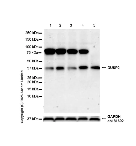 Western blot - Anti-DUSP2/PAC1 antibody [EPR29656-23] (AB323536)