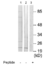 Western blot - Anti-DUSP22 antibody (AB70124)