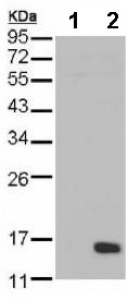 Western blot - Anti-DUSP23 antibody (AB154505), expandable thumbnail