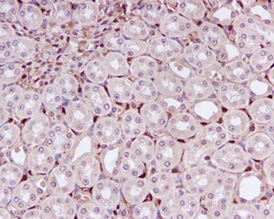 Immunohistochemistry (Formalin/PFA-fixed paraffin-embedded sections) - Anti-DUSP3 antibody [EPR5492] (AB125077)