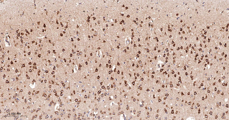 Immunohistochemistry (Formalin/PFA-fixed paraffin-embedded sections) - Anti-DUSP6 antibody [9C3] (AB326708)