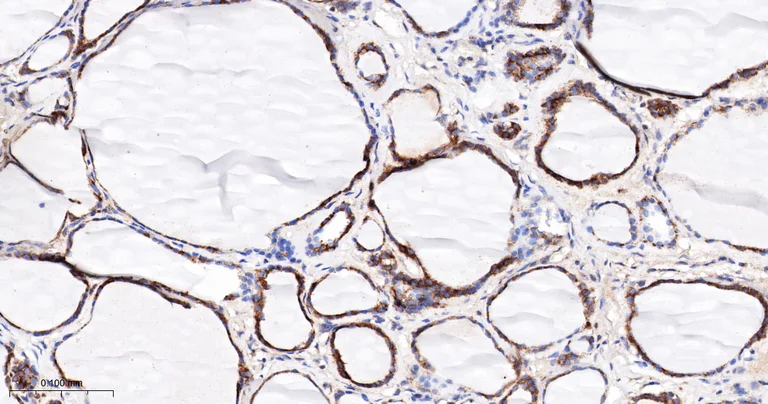 Immunohistochemistry (Formalin/PFA-fixed paraffin-embedded sections) - Anti-DUSP6 antibody [9C3] (AB326708)