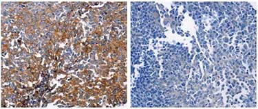 Immunohistochemistry (Formalin/PFA-fixed paraffin-embedded sections) - Anti-DUSP6 antibody (AB182605)