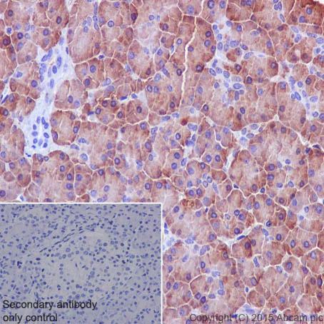 Immunohistochemistry (Formalin/PFA-fixed paraffin-embedded sections) - Anti-DUSP6 antibody [EPR129Y] - BSA and Azide free (AB220811)