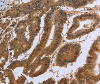 Immunohistochemistry (Formalin/PFA-fixed paraffin-embedded sections) - Anti-DUSP8 antibody - N-terminal (AB198175)
