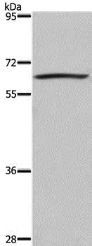 Western blot - Anti-DUSP8 antibody - N-terminal (AB198175)