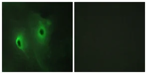 Immunocytochemistry/ Immunofluorescence - Anti-DUSP9 antibody (AB167080)