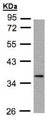Western blot - Anti-DUSP9 antibody - C-terminal (AB152119), expandable thumbnail