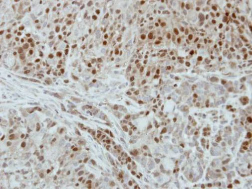 Immunohistochemistry (Formalin/PFA-fixed paraffin-embedded sections) - Anti-dUTPase antibody (AB229122)