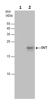 Immunoprecipitation - Anti-dUTPase antibody (AB229122)
