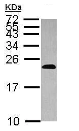 Western blot - Anti-dUTPase antibody (AB229122)