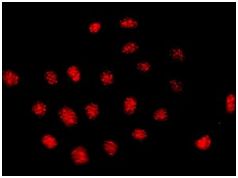 Immunocytochemistry/ Immunofluorescence - Anti-dUTPase antibody [EPR9607(B)] - BSA and Azide free (AB248819), expandable thumbnail