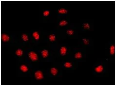 Immunocytochemistry/ Immunofluorescence - Anti-dUTPase antibody [EPR9607(B)] - BSA and Azide free (AB248819)