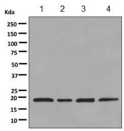 Western blot - Anti-dUTPase antibody [EPR9607(B)] - BSA and Azide free (AB248819), expandable thumbnail