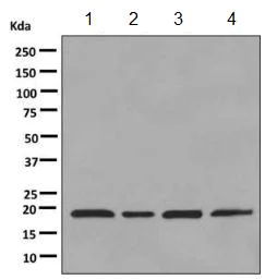 Western blot - Anti-dUTPase antibody [EPR9607(B)] - BSA and Azide free (AB248819)