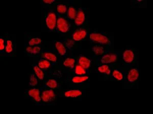 Immunocytochemistry/ Immunofluorescence - Anti-dUTPase antibody [EPR9608(B)] (AB137097)