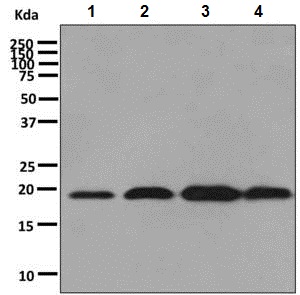 Anti-dUTPase antibody [EPR9608(B)]
